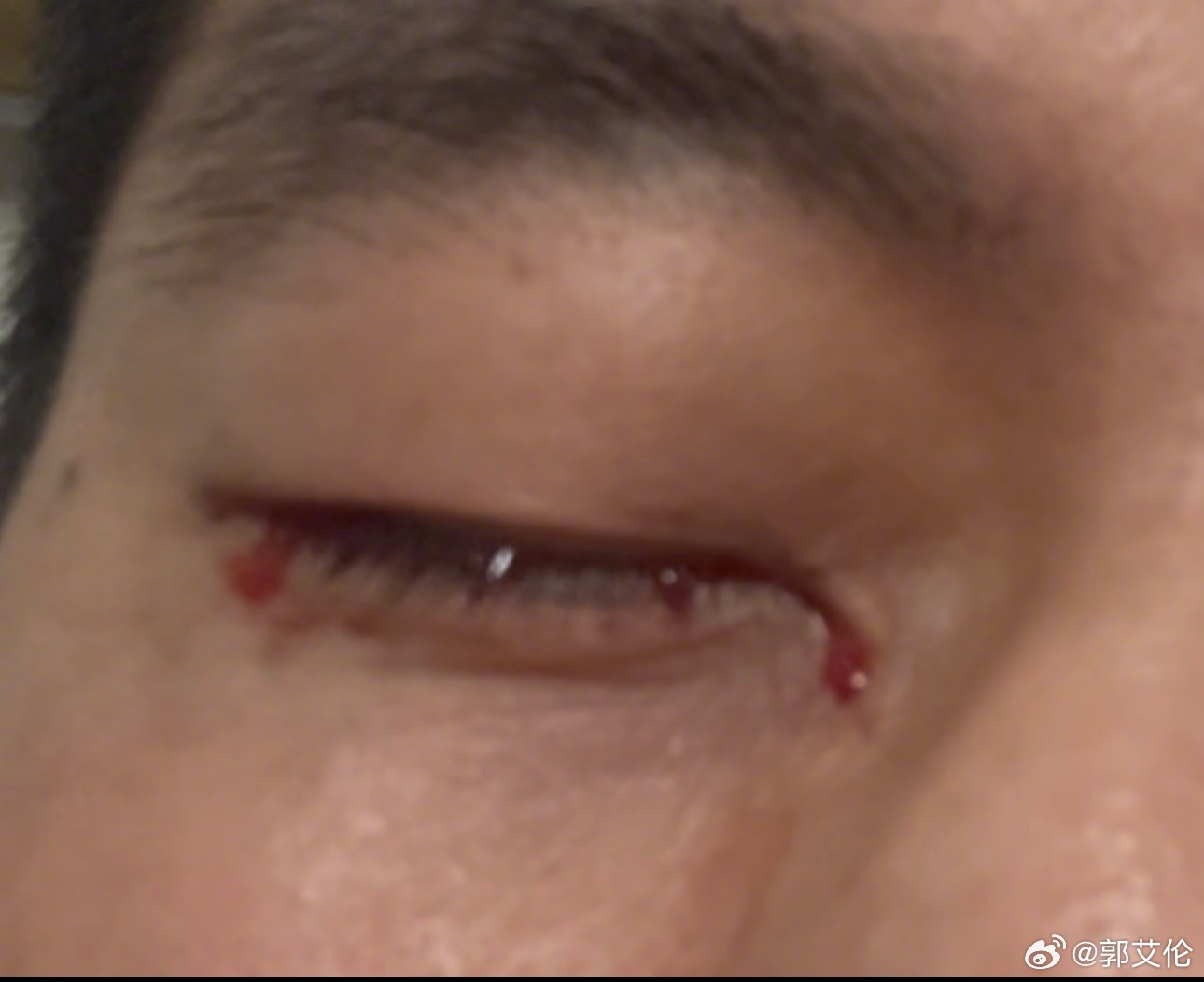 DB视讯官网红星新闻:郭艾伦受伤是在训练最后一个回合 在场的球员都很自责